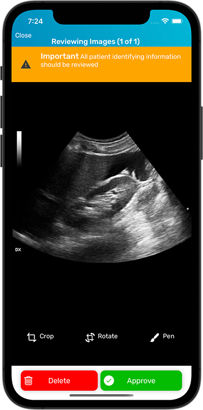 Log My Scan Ultrasound Logbook Secure Image Upload and Anonymisation